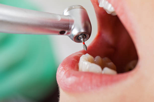 Best Pediatric Emergency Dentist in Contra Costa Centre, CA